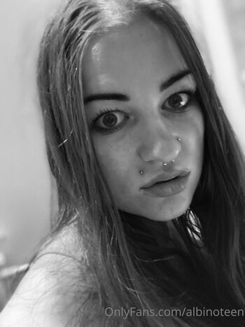 albinoteen