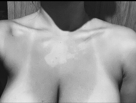 Analag.a