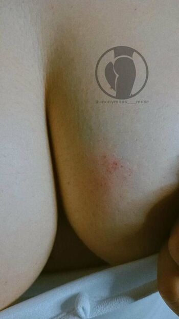 Anonymous___muse