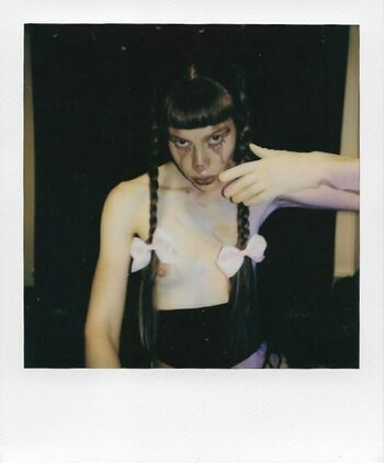 bb.apathy