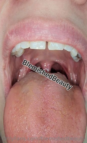 blemishedbeauty