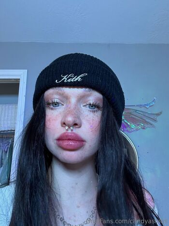 candyasmus