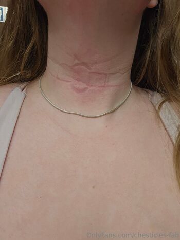 chesticles-fab