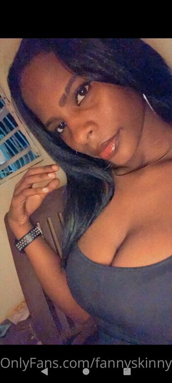 fannyskinny01