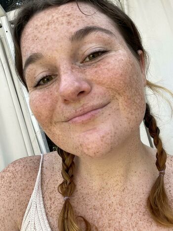 Freckled Baby