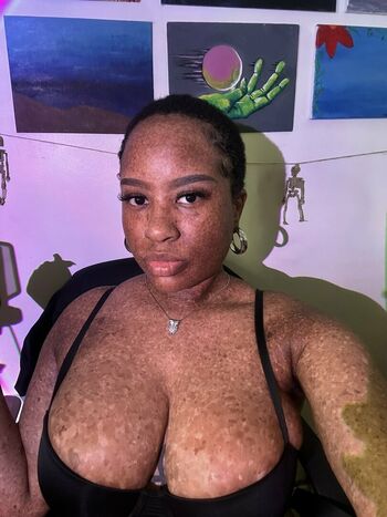 freckledn