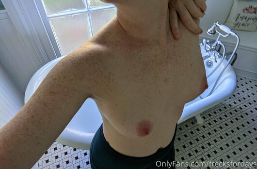 frecksfordays