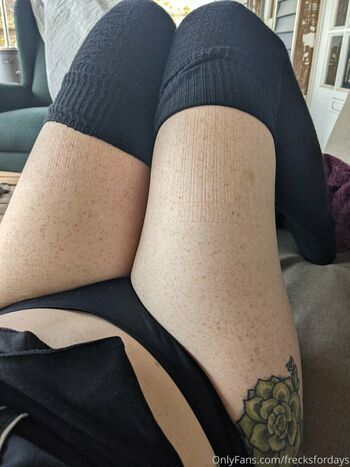 frecksfordays