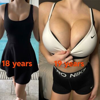 Growing Breasts