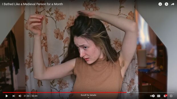 Hairy Women