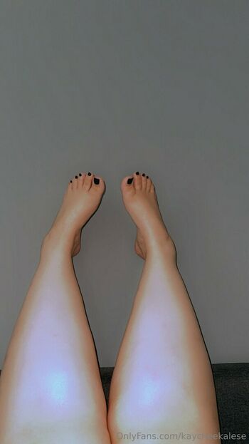 kaycheekalese