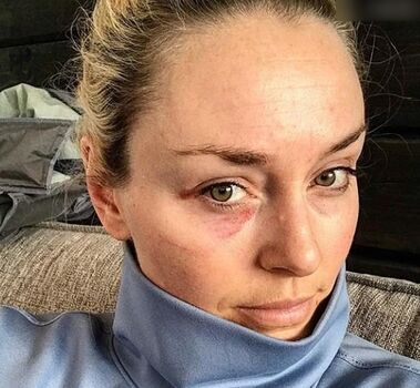 Lindsey Vonn