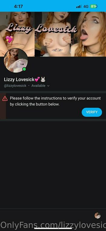 lizzylovesickfree