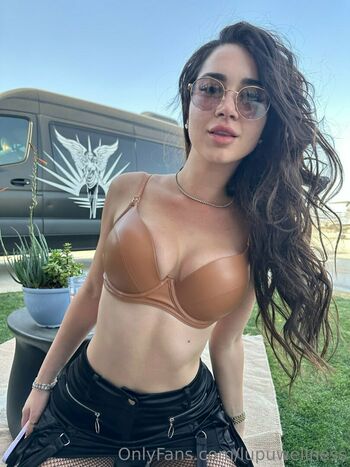 Lupuwellness