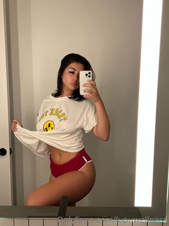 Lupuwellness