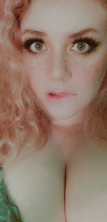 Lydiasoddities