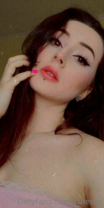 mi_ameli