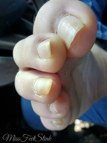 missfeetstink