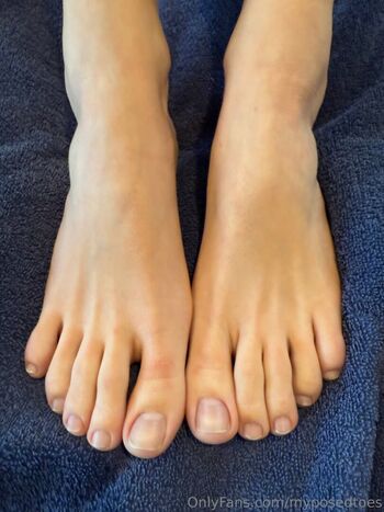 myposedtoes