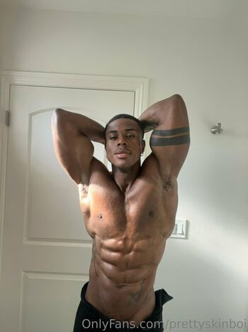prettyskinboi