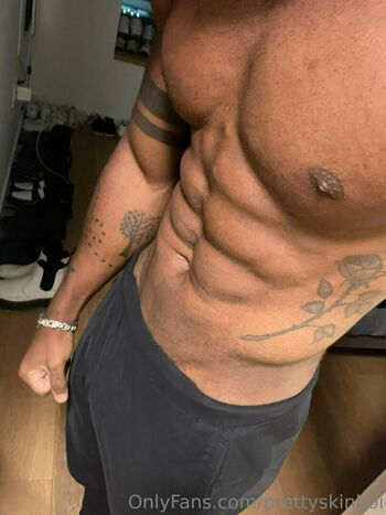 prettyskinboi