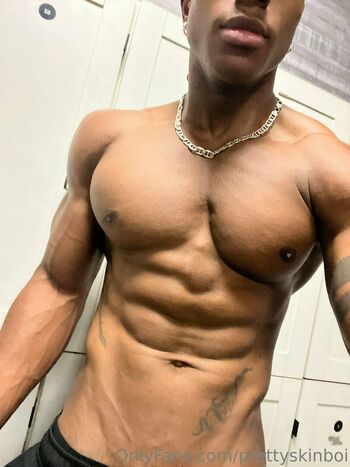 prettyskinboi