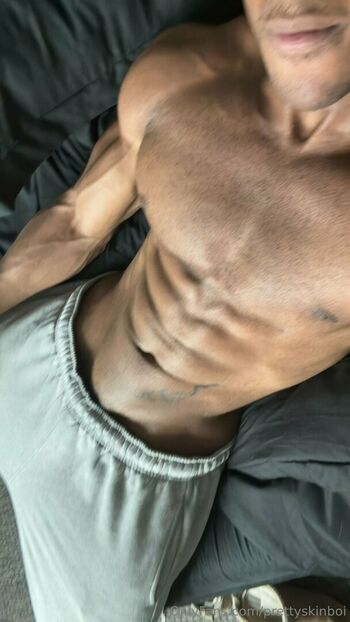 prettyskinboi