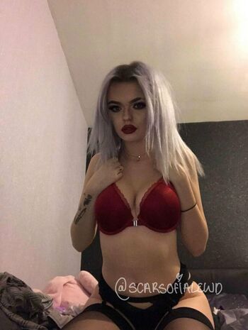 scarsofialewd