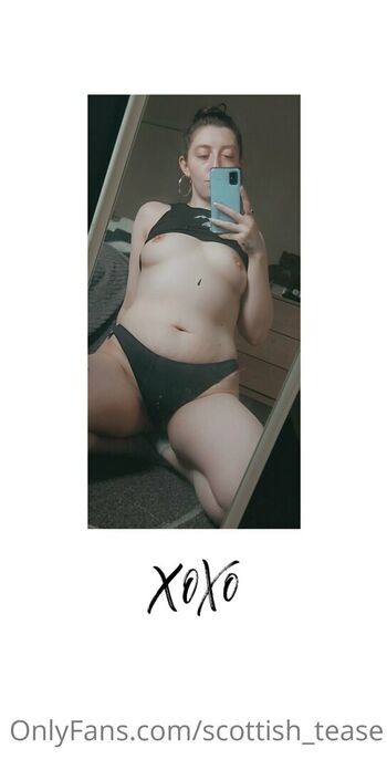 scottish_tease