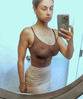 Skinnyroti