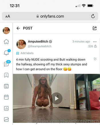 theamputeebitch