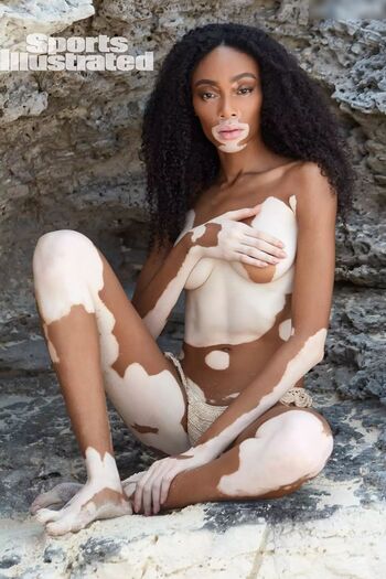 Winnie Harlow