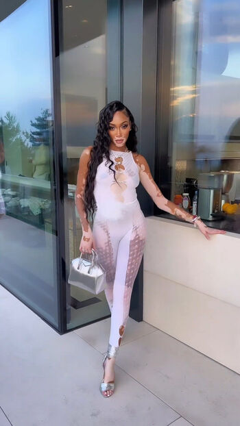 Winnie Harlow