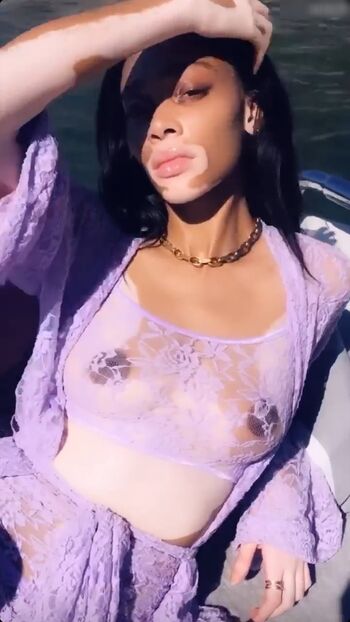 Winnie Harlow