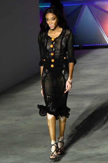 Winnie Harlow