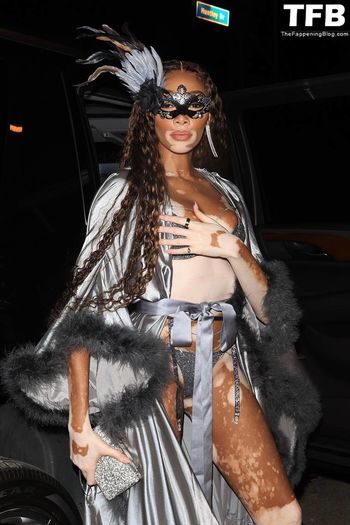 Winnie Harlow