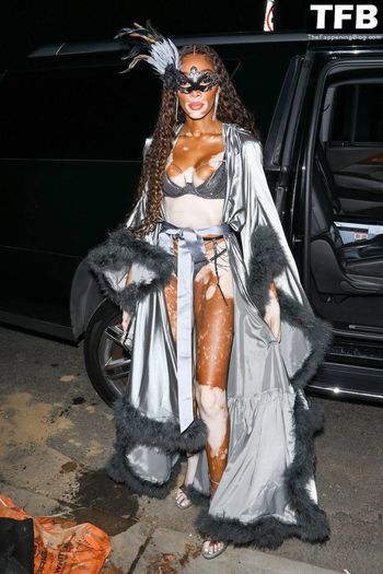 Winnie Harlow
