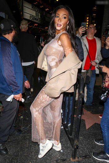 Winnie Harlow