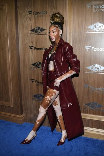 Winnie Harlow