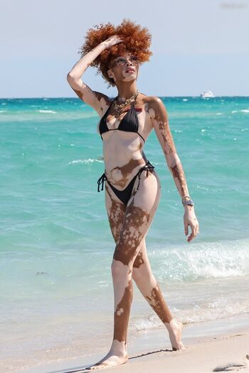 Winnie Harlow