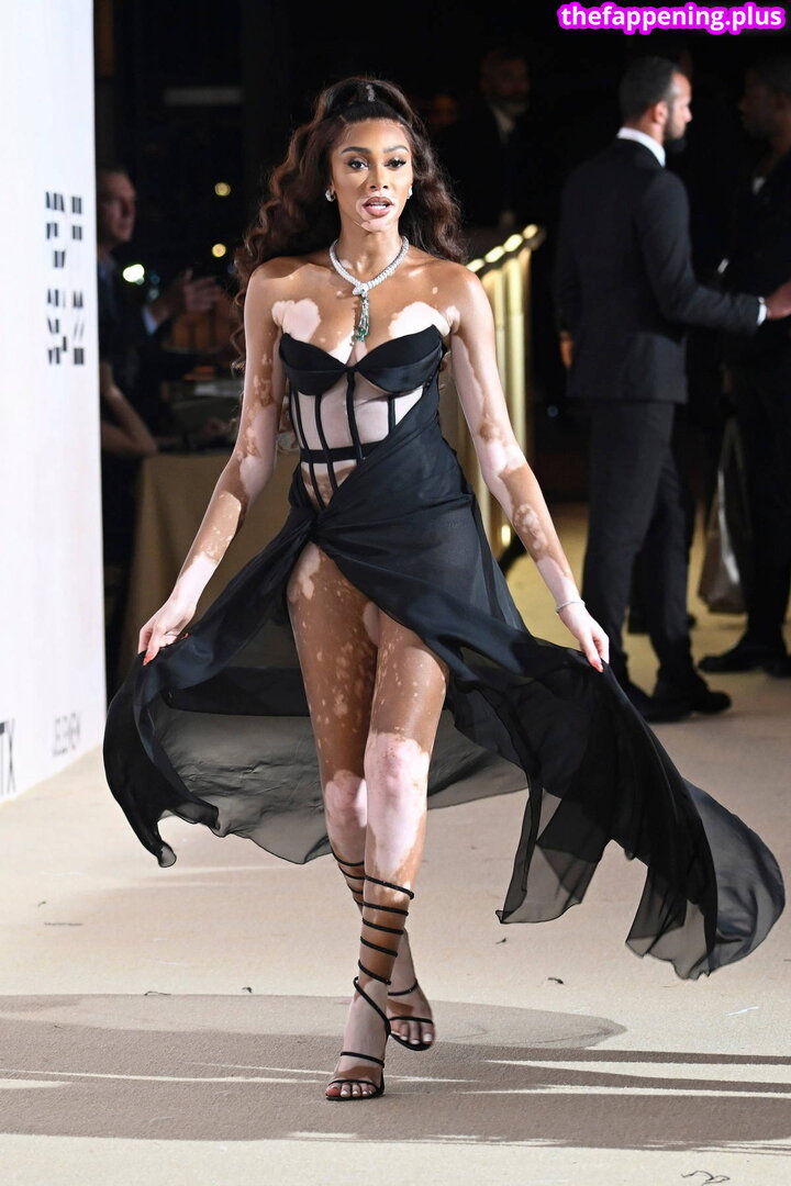 Winnie Harlow