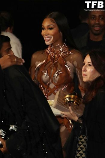 Winnie Harlow