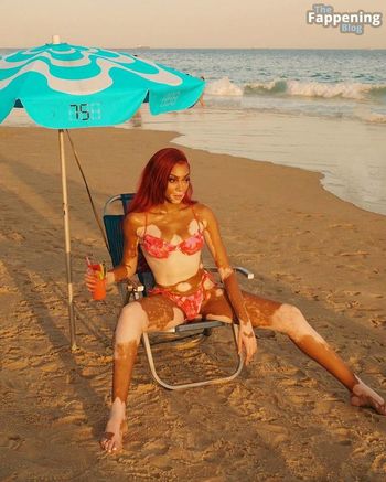 Winnie Harlow