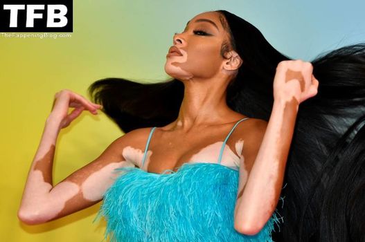 Winnie Harlow