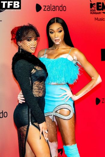 Winnie Harlow