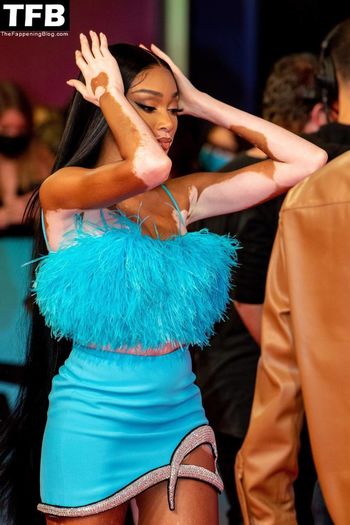 Winnie Harlow