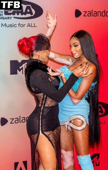 Winnie Harlow