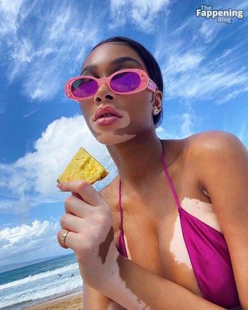 Winnie Harlow