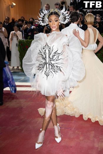Winnie Harlow