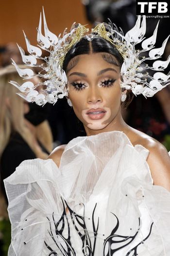 Winnie Harlow